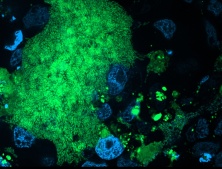 Infektion von Wirtszellen mit Vibrio cholerae