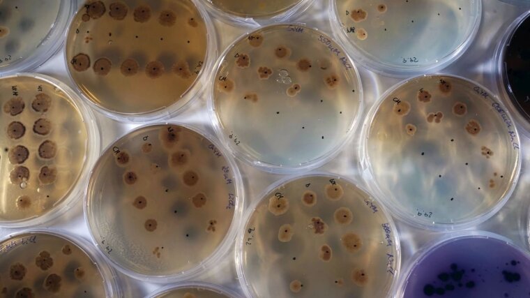 Petri dishes with bacterial cultures.